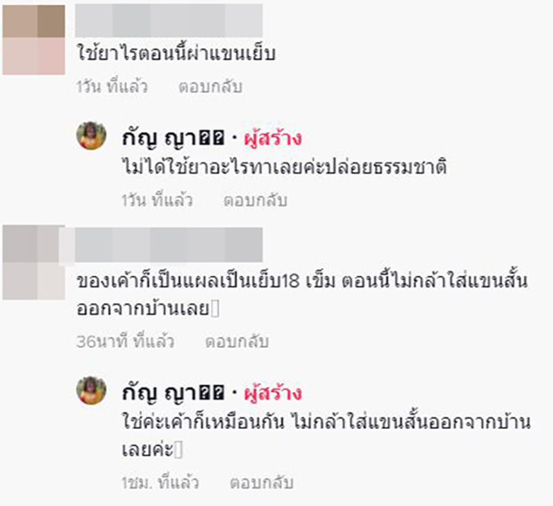 สาวแชร์ประสบการณ์ เกือบต้องตัดแขนเพราะงูเขียวหางไหม้ สาวแชร์ประสบการณ์ เกือบต้องตัดแขนเพราะงูเขียวหางไหม้