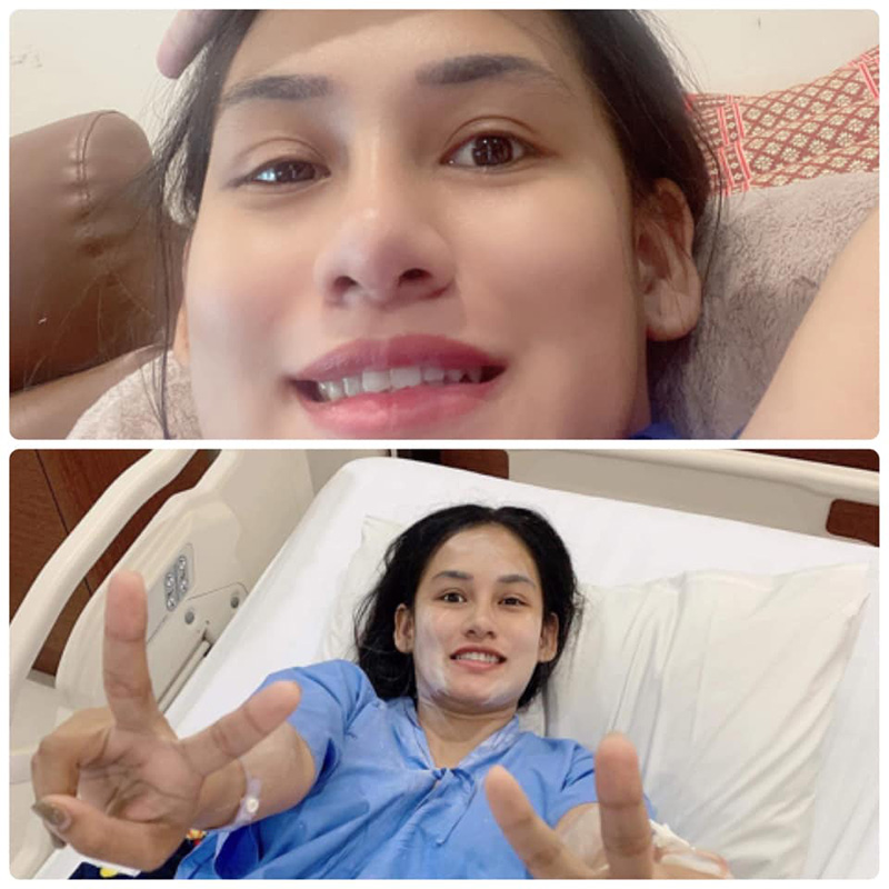 สาวแชร์ประสบการณ์ เส้นเลือดในสมองตีบ สาวแชร์ประสบการณ์ เส้นเลือดในสมองตีบ