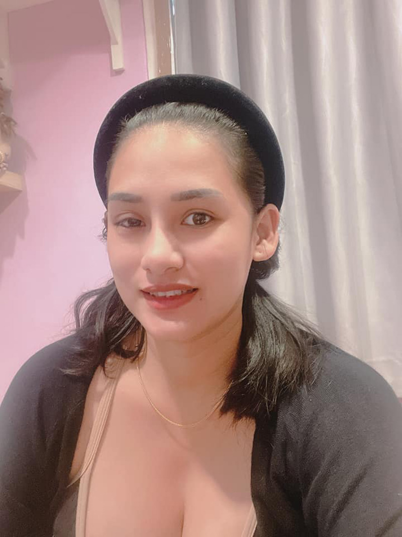 สาวแชร์ประสบการณ์ เส้นเลือดในสมองตีบ สาวแชร์ประสบการณ์ เส้นเลือดในสมองตีบ