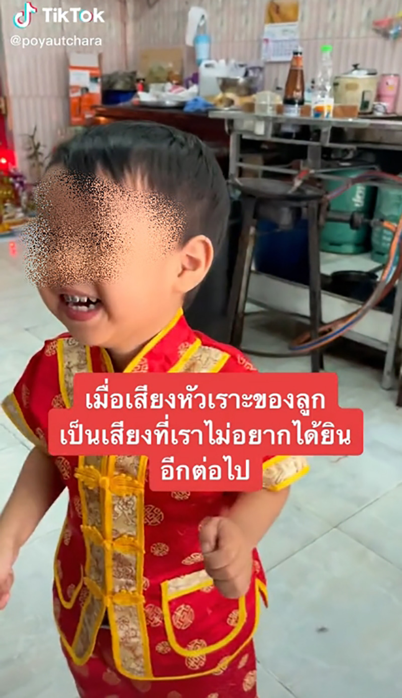 แม่แชร์ประสบการณ์ ลูกน้อยป่วยเนื้องอกหัวเราะ แม่แชร์ประสบการณ์ ลูกน้อยป่วยเนื้องอกหัวเราะ