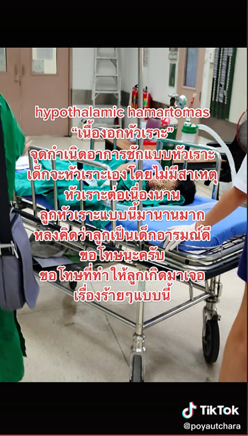 แม่แชร์ประสบการณ์ ลูกน้อยป่วยเนื้องอกหัวเราะ แม่แชร์ประสบการณ์ ลูกน้อยป่วยเนื้องอกหัวเราะ