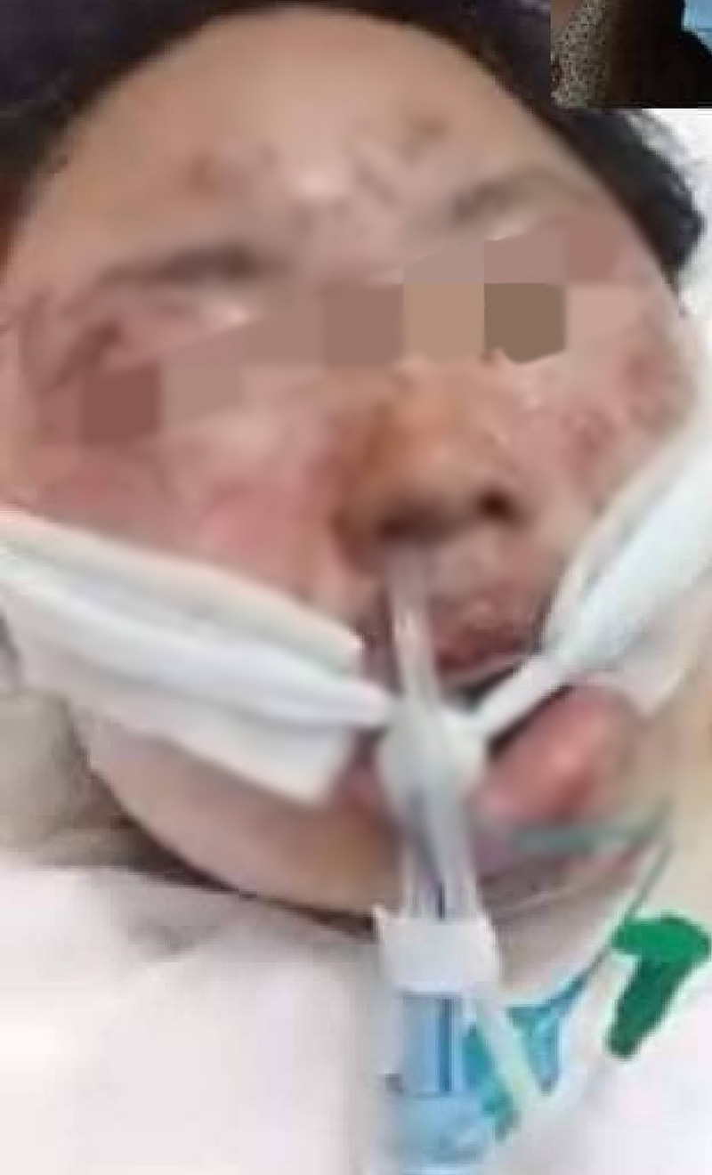 ไฟลุกพรึ่บไหม้ทั่วร่าง ไฟลุกพรึ่บไหม้ทั่วร่าง