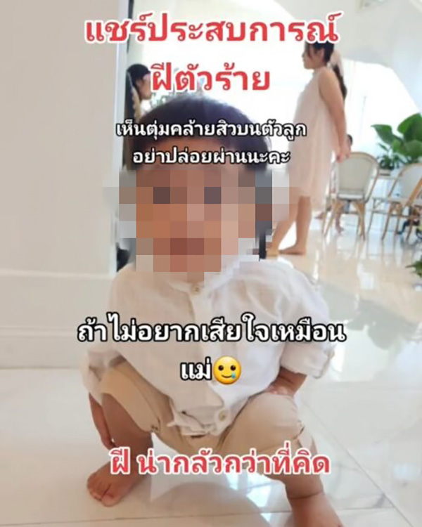 ลูกตุ่มแดงขึ้นนึกว่าแมลงกัด ก่อนทรุดส่งโรงพยาบาล ลูกตุ่มแดงขึ้นนึกว่าแมลงกัด ก่อนทรุดส่งโรงพยาบาล
