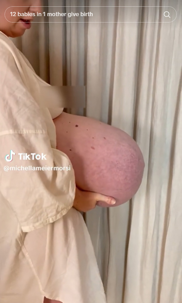 คุณแม่แฝดสาม อวดหน้าท้องตอปิโด ใหญ่โตแปลกตา จนเป็นไวรัล 137 ล้านวิว คุณแม่แฝดสาม อวดหน้าท้องตอปิโด ใหญ่โตแปลกตา จนเป็นไวรัล 137 ล้านวิว