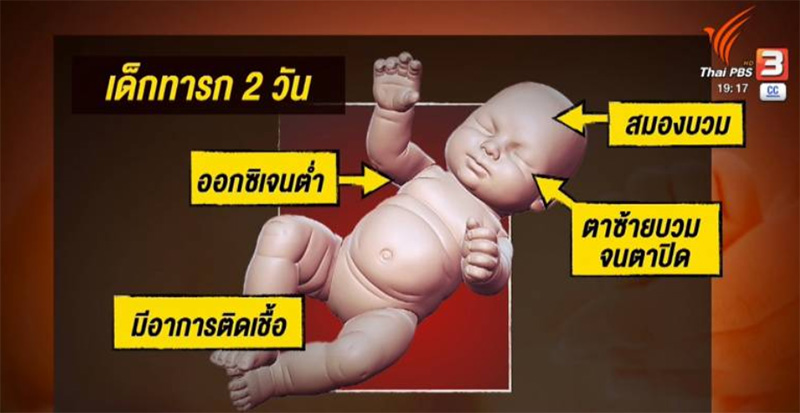 ทารก 2 วัน ถูกขโมยจาก รพ ทารก 2 วัน ถูกขโมยจาก รพ