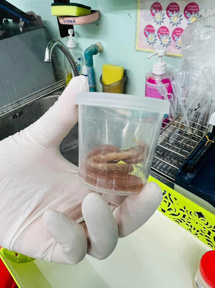 พยาธิไส้เดือน 2 ตัว ขนาดเบิ้ม พยาธิไส้เดือน 2 ตัว ขนาดเบิ้ม