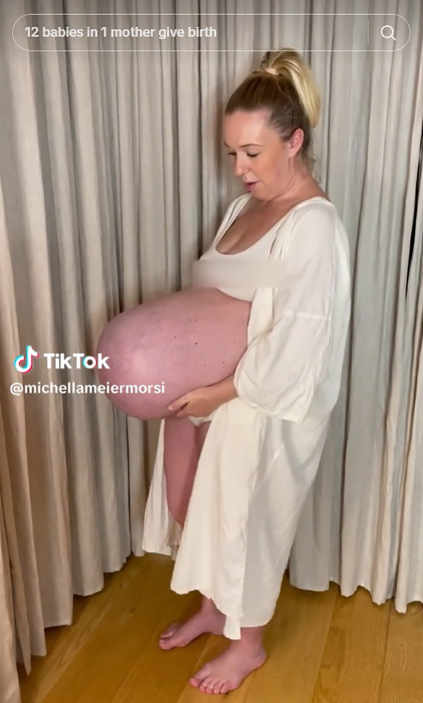 คุณแม่แฝดสาม อวดหน้าท้องตอปิโด ใหญ่โตแปลกตา จนเป็นไวรัล 137 ล้านวิว คุณแม่แฝดสาม อวดหน้าท้องตอปิโด ใหญ่โตแปลกตา จนเป็นไวรัล 137 ล้านวิว