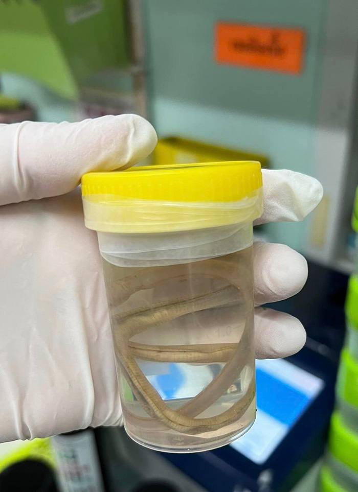 พยาธิไส้เดือน 2 ตัว ขนาดเบิ้ม พยาธิไส้เดือน 2 ตัว ขนาดเบิ้ม