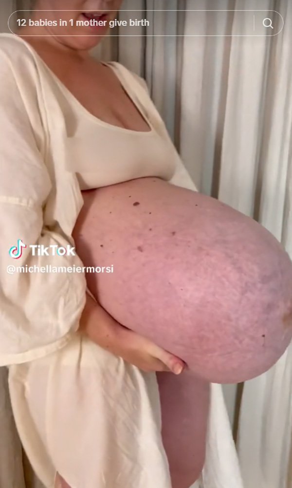 คุณแม่แฝดสาม อวดหน้าท้องตอปิโด ใหญ่โตแปลกตา จนเป็นไวรัล 137 ล้านวิว คุณแม่แฝดสาม อวดหน้าท้องตอปิโด ใหญ่โตแปลกตา จนเป็นไวรัล 137 ล้านวิว