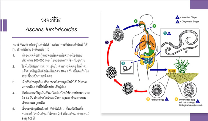พยาธิไส้เดือน 2 ตัว ขนาดเบิ้ม พยาธิไส้เดือน 2 ตัว ขนาดเบิ้ม