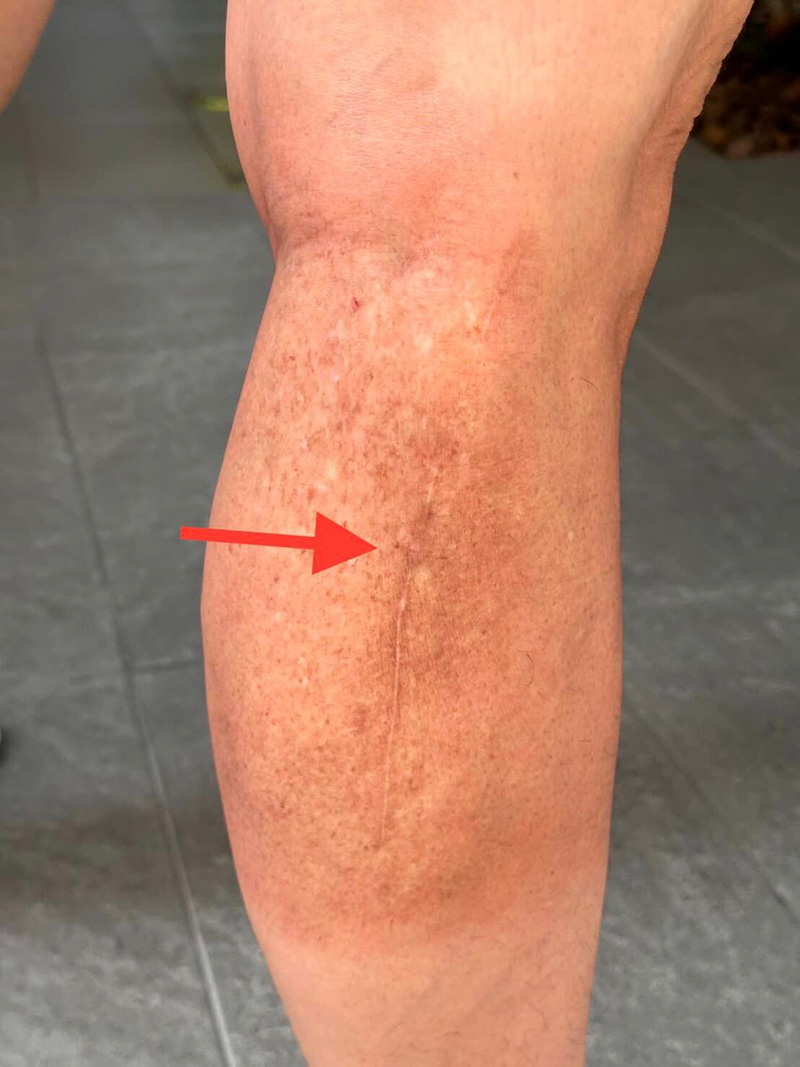 ก้อนเนื้อผิดปกติ ก้อนเนื้อผิดปกติ