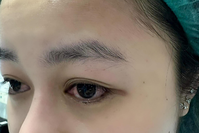 พยาบาลท้อใจ เสียสละเวลาส่วนตัวขึ้นเวร แต่ถูกคนไข้ทำร้าย พยาบาลท้อใจ เสียสละเวลาส่วนตัวขึ้นเวร แต่ถูกคนไข้ทำร้าย