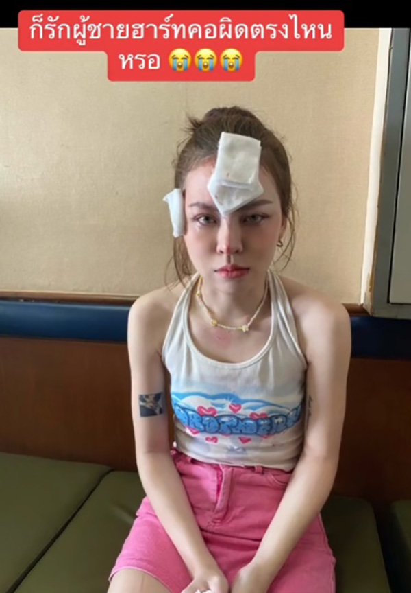 สาวเป็นแผลเต็มหน้า พ้อ รักผู้ชายฮาร์ดคอร์ผิดตรงไหน สาวเป็นแผลเต็มหน้า พ้อ รักผู้ชายฮาร์ดคอร์ผิดตรงไหน