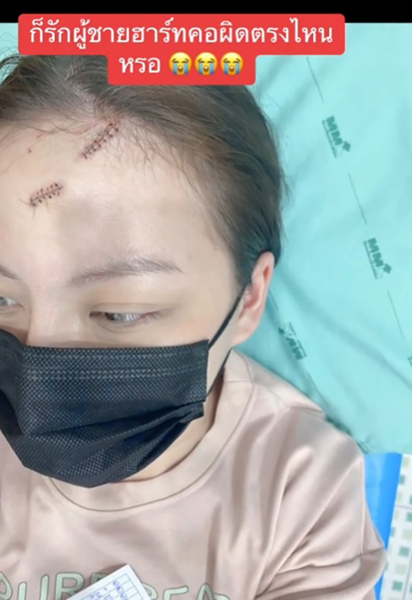 สาวเป็นแผลเต็มหน้า พ้อ รักผู้ชายฮาร์ดคอร์ผิดตรงไหน สาวเป็นแผลเต็มหน้า พ้อ รักผู้ชายฮาร์ดคอร์ผิดตรงไหน