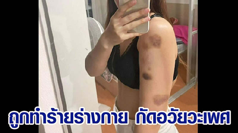 หนุ่มลูกเจ้าของ รร. โต้สาว ไม่ได้เรียกเซ็กส์ซาดิสม์ แต่เรียกเซ็กส์แบบฝรั่ง หนุ่มลูกเจ้าของ รร. โต้สาว ไม่ได้เรียกเซ็กส์ซาดิสม์ แต่เรียกเซ็กส์แบบฝรั่ง