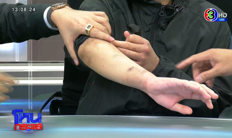 นายจ้างทรมานลูกจ้าง นายจ้างทรมานลูกจ้าง