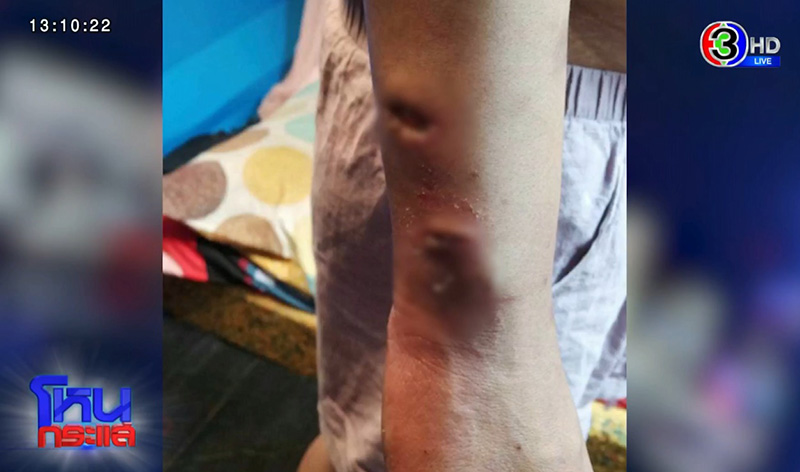 นายจ้างทรมานลูกจ้าง นายจ้างทรมานลูกจ้าง