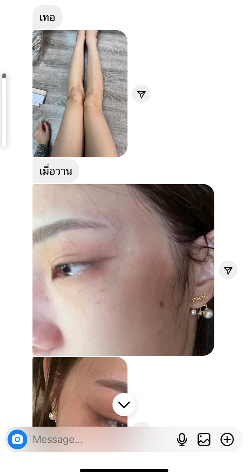 เพื่อนเปิดแชต จีจี้ สุพิชชา ส่งรูปตอนถูก นตท ทำร้ายน่วม เพื่อนเปิดแชต จีจี้ สุพิชชา ส่งรูปตอนถูก นตท ทำร้ายน่วม