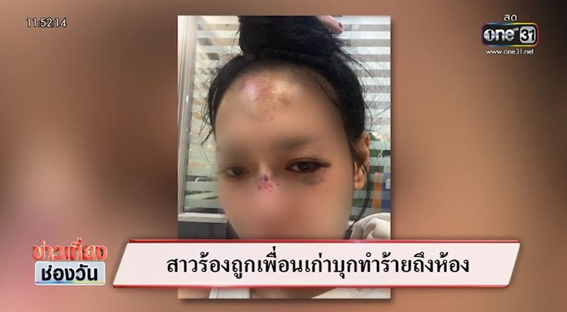 บุกคอนโดฟาดเพื่อนน่วม รู้แล้วอึ้งเลย หนุ่มบาร์โฮสต์เป็นเหตุ บุกคอนโดฟาดเพื่อนน่วม รู้แล้วอึ้งเลย หนุ่มบาร์โฮสต์เป็นเหตุ