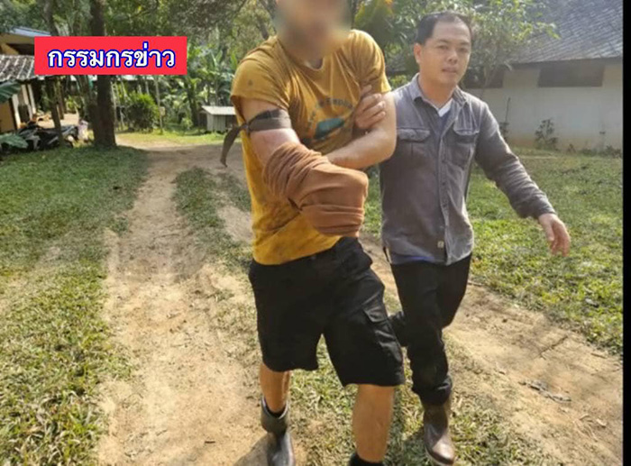 คนบาดเจ็บ คนบาดเจ็บ