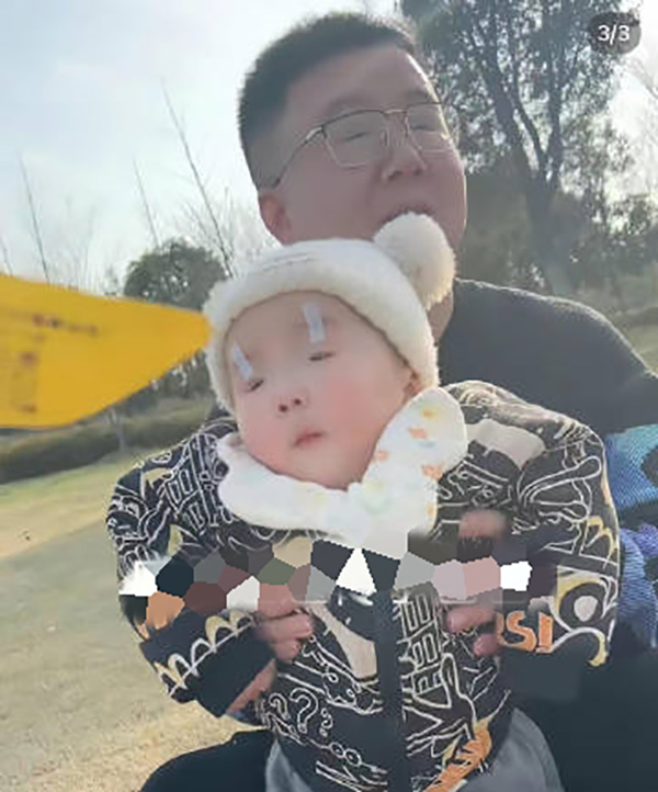 แม่โอดลูกตาเล็กมาก จนต้องเอาเทปติด แม่โอดลูกตาเล็กมาก จนต้องเอาเทปติด