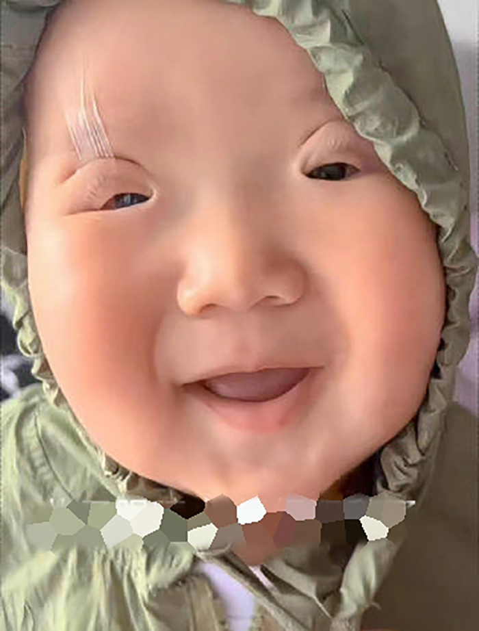 แม่โอดลูกตาเล็กมาก จนต้องเอาเทปติด แม่โอดลูกตาเล็กมาก จนต้องเอาเทปติด