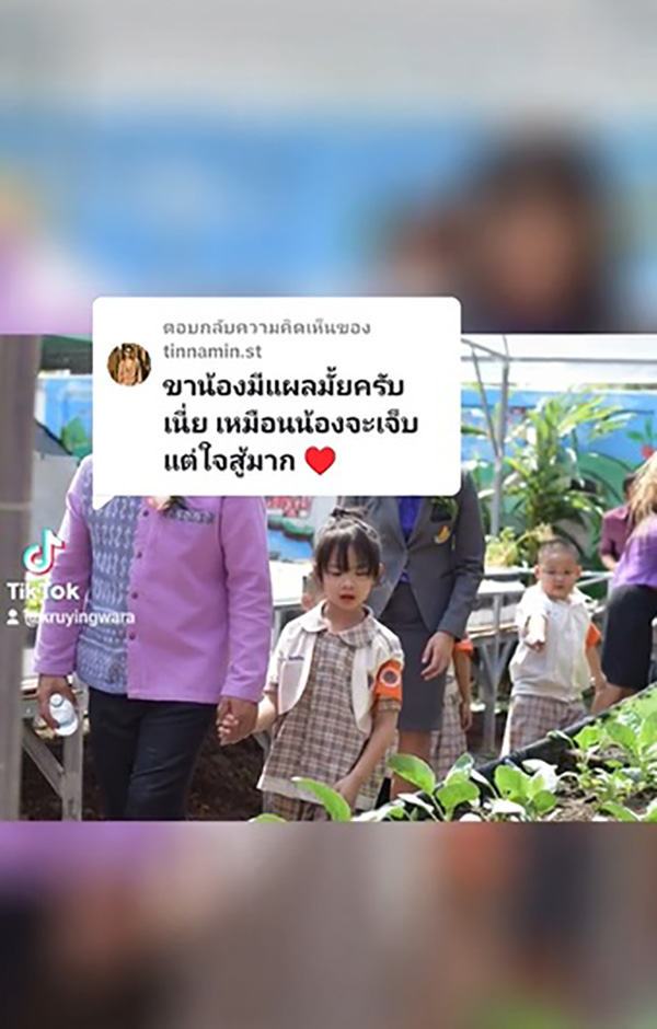 เด็กโชว์ดีดไห เด็กโชว์ดีดไห