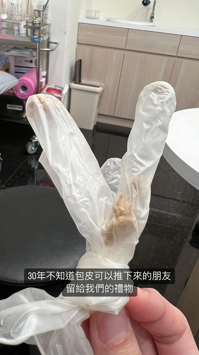 ชายเจอก้อนประหลาดตอนอาบน้ำ ชายเจอก้อนประหลาดตอนอาบน้ำ