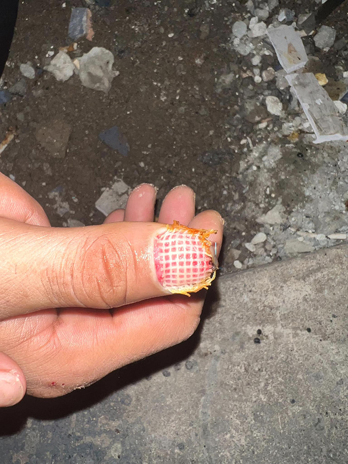 ใบเลื่อยเครื่องเจียรตัดเข้านิ้ว ใบเลื่อยเครื่องเจียรตัดเข้านิ้ว