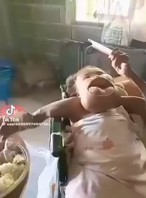 หญิงป่วยมะเร็งปากระยะสุดท้าย หญิงป่วยมะเร็งปากระยะสุดท้าย