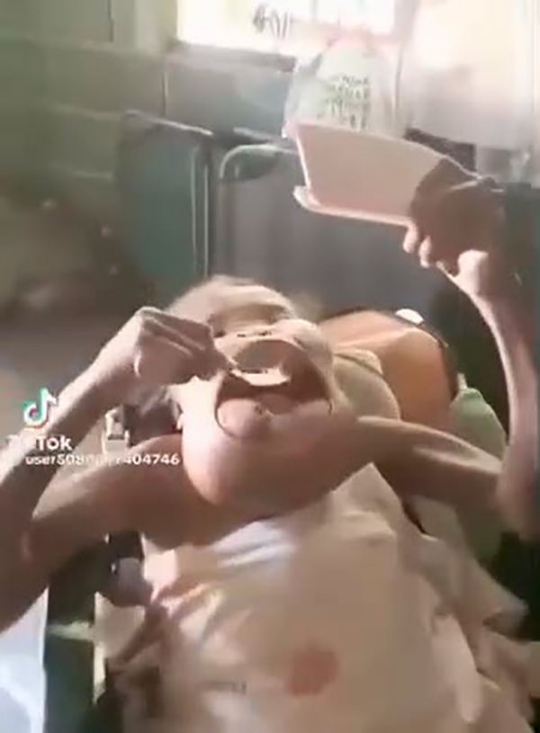 หญิงป่วยมะเร็งปากระยะสุดท้าย หญิงป่วยมะเร็งปากระยะสุดท้าย