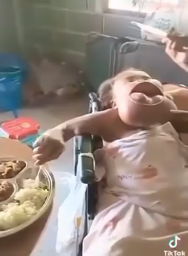 หญิงป่วยมะเร็งปากระยะสุดท้าย หญิงป่วยมะเร็งปากระยะสุดท้าย