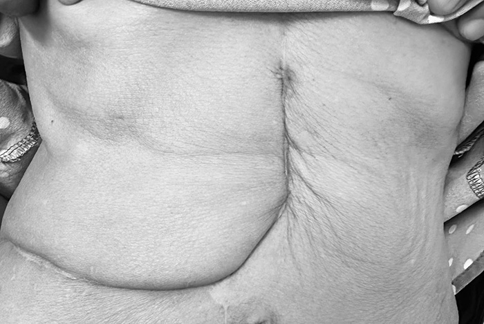 หญิงวัย 50 เป็นมะเร็งมา 9 ปี ทรมานมาก หญิงวัย 50 เป็นมะเร็งมา 9 ปี ทรมานมาก