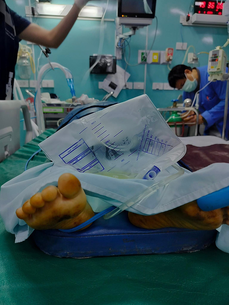 เด็ก 5 ขวบเผลอดื่มสารไซยาไนด์ เด็ก 5 ขวบเผลอดื่มสารไซยาไนด์