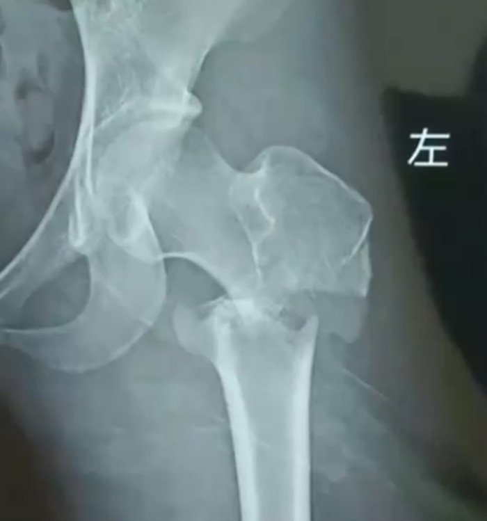 กระดูก กระดูก