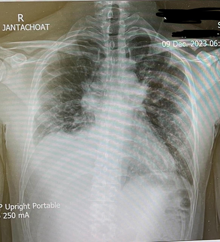 พตต รุ่งคุณ พตต รุ่งคุณ