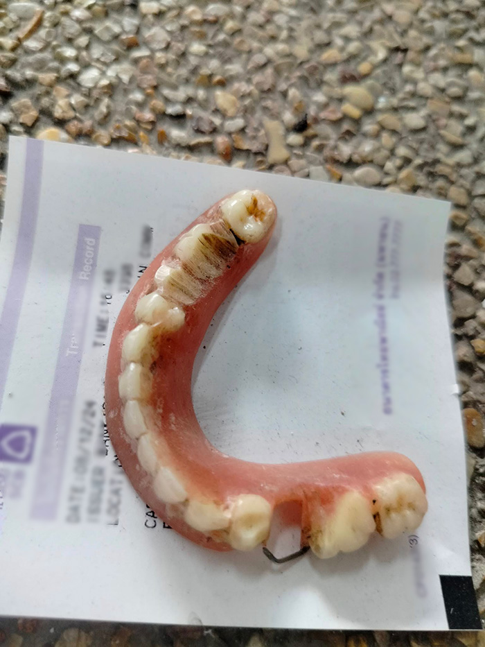 พบฟันปลอมปริศนา วางบนสลิปใน รพ พบฟันปลอมปริศนา วางบนสลิปใน รพ