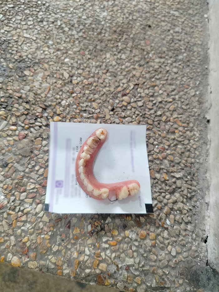 พบฟันปลอมปริศนา วางบนสลิปใน รพ พบฟันปลอมปริศนา วางบนสลิปใน รพ