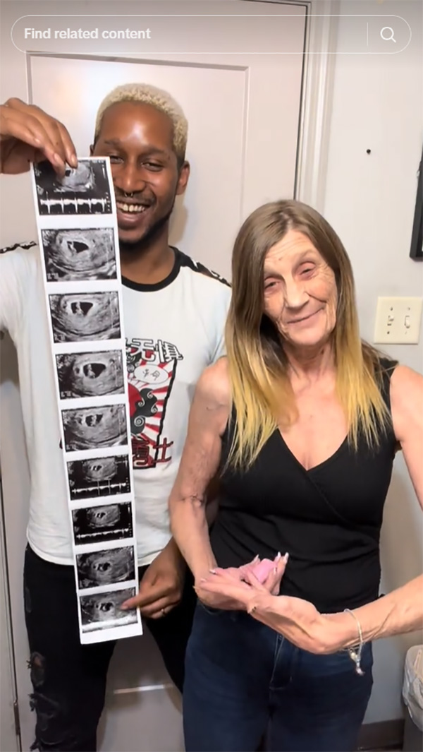 หญิงวัย 63 สานรักผัวเด็กวัย 22 หญิงวัย 63 สานรักผัวเด็กวัย 22