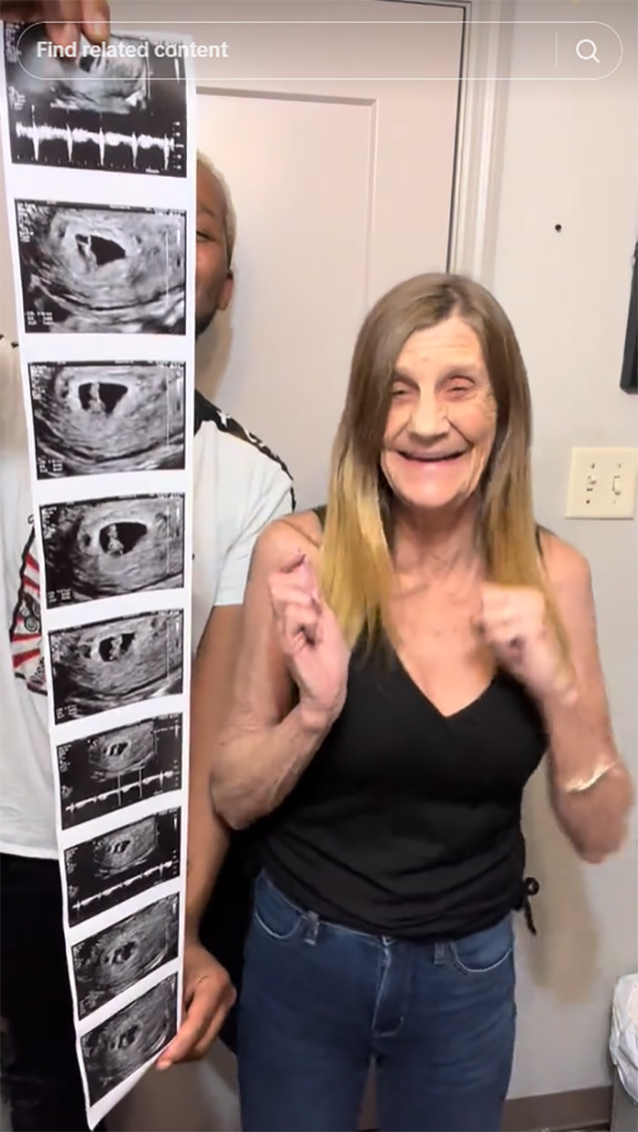 หญิงวัย 63 สานรักผัวเด็กวัย 22 หญิงวัย 63 สานรักผัวเด็กวัย 22