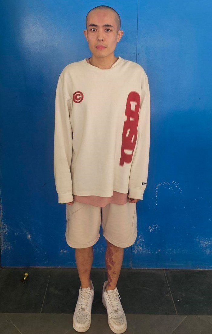 ภาพล่าสุด ซิงซิง ถูกโกนผม ภาพล่าสุด ซิงซิง ถูกโกนผม