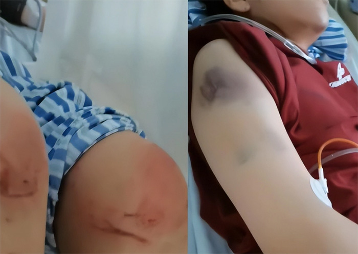 วิจารณ์เดือด เมียถูกผัวทำร้าย วิจารณ์เดือด เมียถูกผัวทำร้าย