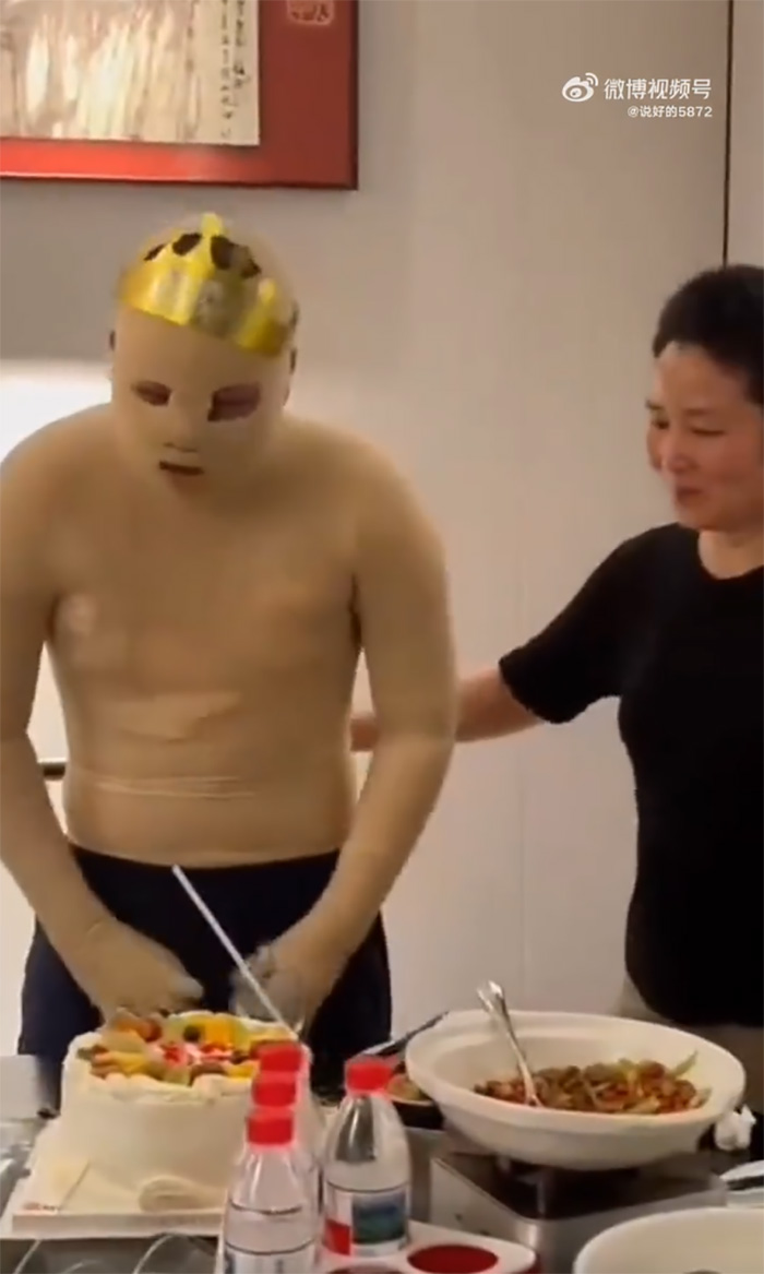 หนุ่มหล่อหวิดดับ เหตุแบต จักรยานไฟฟ้าระเบิด หนุ่มหล่อหวิดดับ เหตุแบต จักรยานไฟฟ้าระเบิด