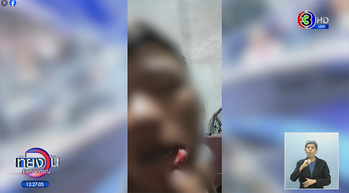 ว่อนคลิป ม ต้น โดนทำร้าย ว่อนคลิป ม ต้น โดนทำร้าย