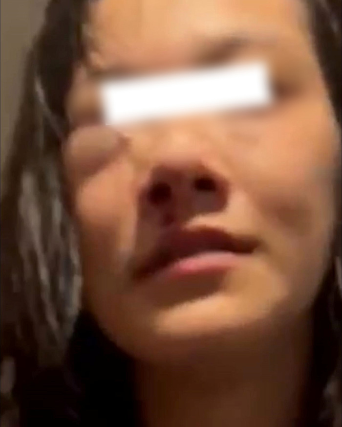 นางเอกเอ็มวีดัง โดนแฟนเก่าตีหัวเลือดอาบ นางเอกเอ็มวีดัง โดนแฟนเก่าตีหัวเลือดอาบ