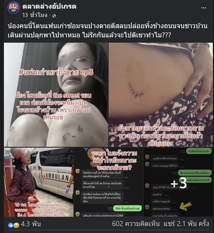 นางเอกเอ็มวีดัง โดนแฟนเก่าตีหัวเลือดอาบ นางเอกเอ็มวีดัง โดนแฟนเก่าตีหัวเลือดอาบ