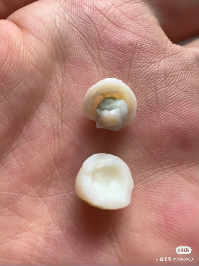 ปอกไข่ต้มเจอเม็ดประหลาด ปอกไข่ต้มเจอเม็ดประหลาด