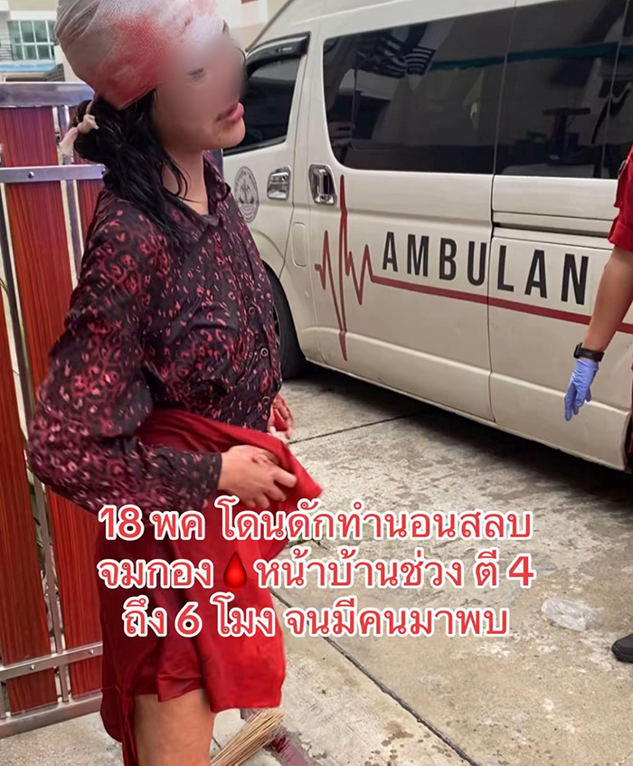 นางเอกเอ็มวีดัง โดนแฟนเก่าตีหัวเลือดอาบ นางเอกเอ็มวีดัง โดนแฟนเก่าตีหัวเลือดอาบ