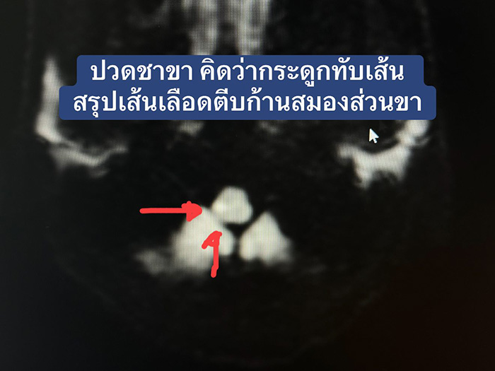 ขาชา ขาชา