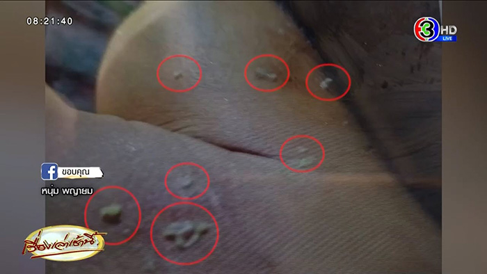 ชายหาหน่อไม้ในป่า กลับมาป่วยประหลาด ชายหาหน่อไม้ในป่า กลับมาป่วยประหลาด